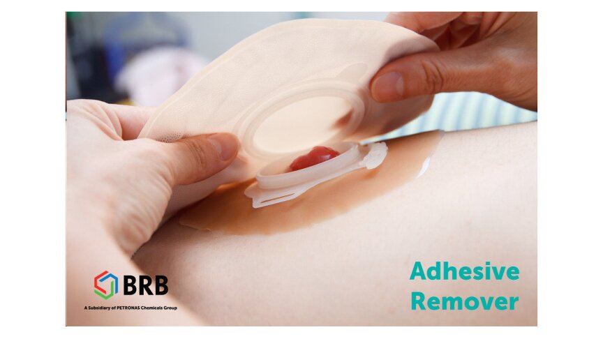 Polydimethylsiloxane based adhesive remover for ostomy application